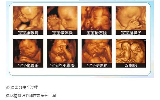 QQ截图20170413145459.jpg